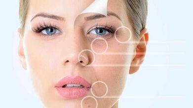 Facial rejuvenation